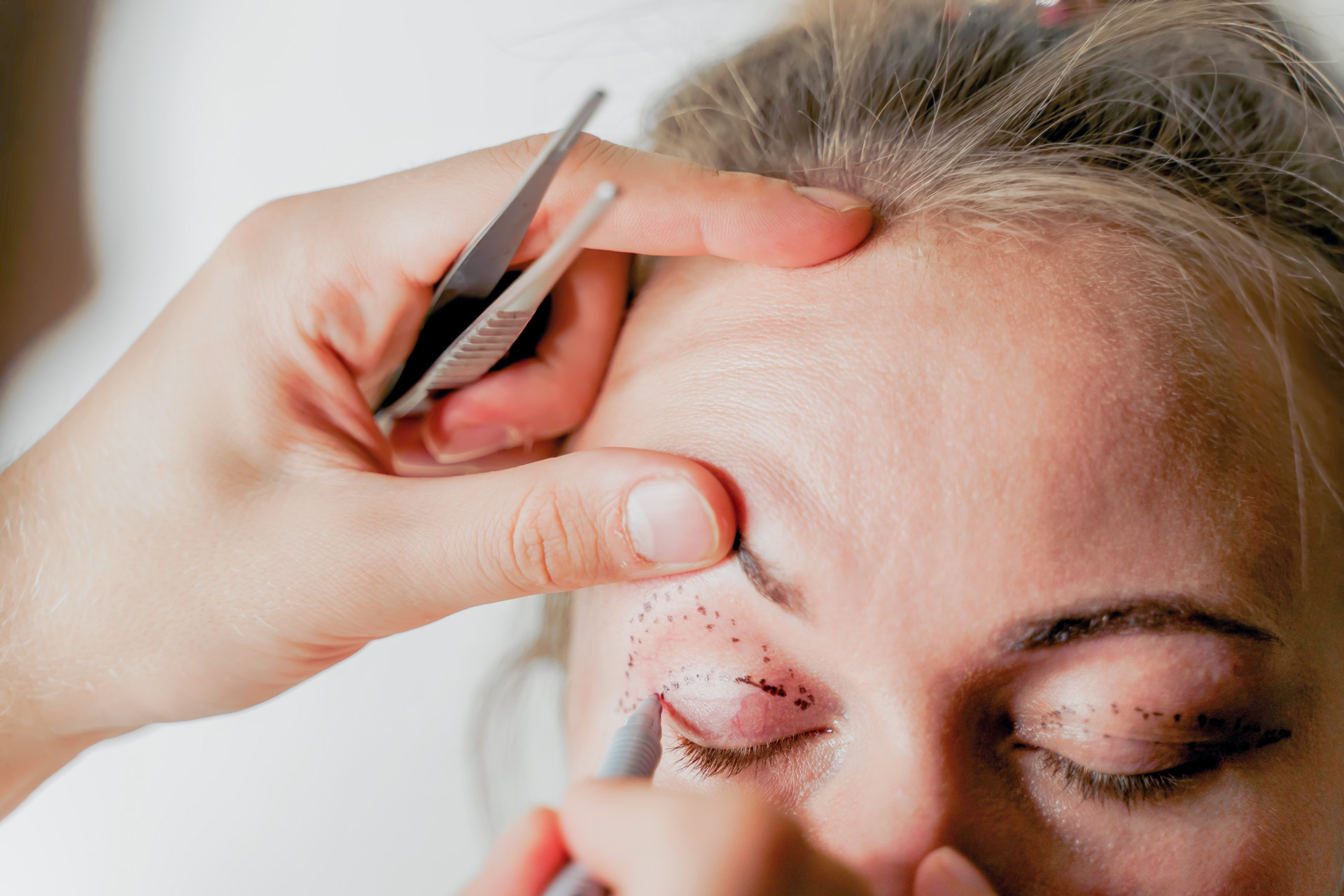 Eyelid Surgery Consultation