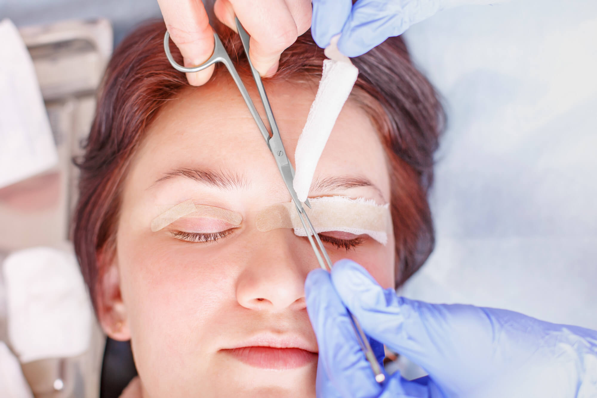 Blepharoplasty Procedure